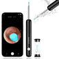 Smart HD Ear Wax Removal Camera – Safe, Clear & Easy Ear Cleaning