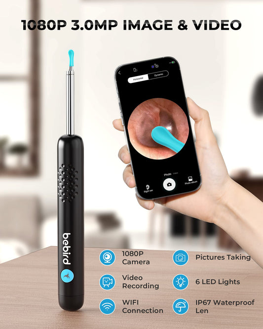 Smart HD Ear Wax Removal Camera – Safe, Clear & Easy Ear Cleaning